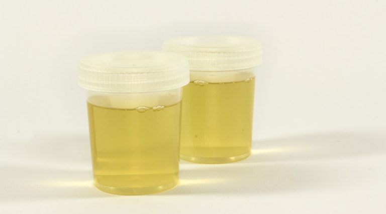 synthetic-urine