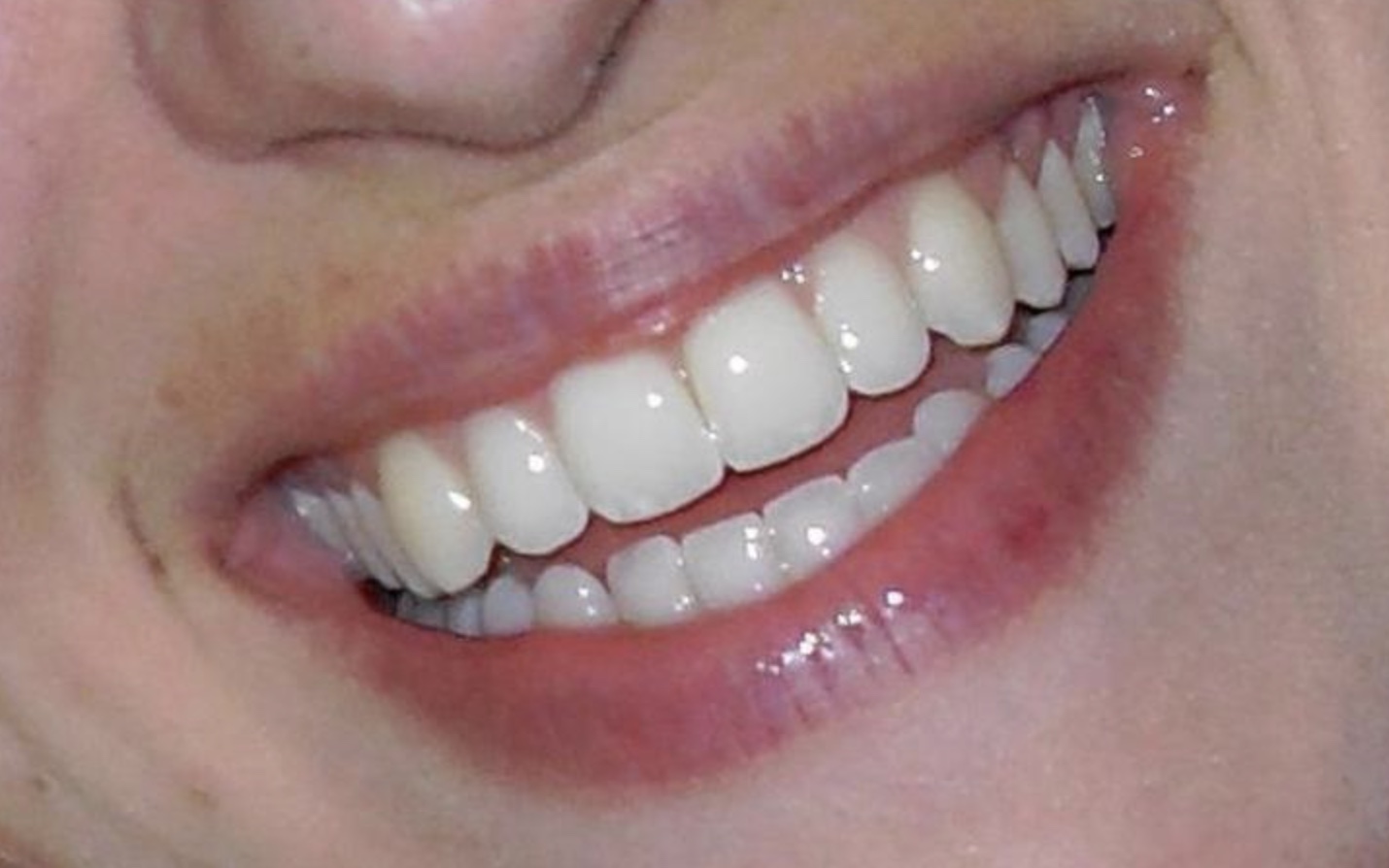 How To Maintain Healthy Teeth For Life The Secret Of Perfect Teeth